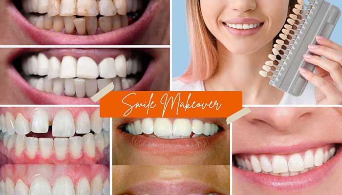 Dental At Forest Hill – Smile Design
