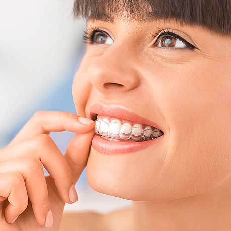 Cosmetic Dentistry Invisible Braces atForest Hill, Vic