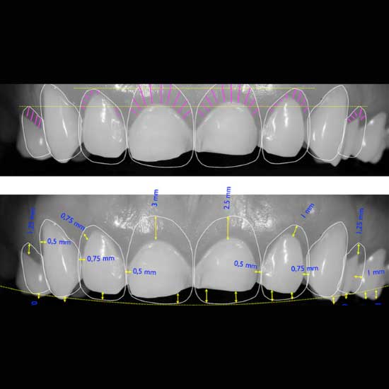 Digital Smile Designing