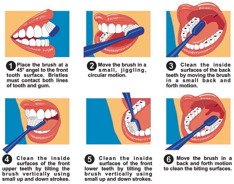 How to Brush your Teeth Effectively | Dentist in Forest Hill