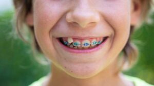 Orthodontic Evaluations for Your Child