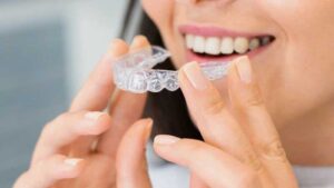 15 Facts about Invisalign