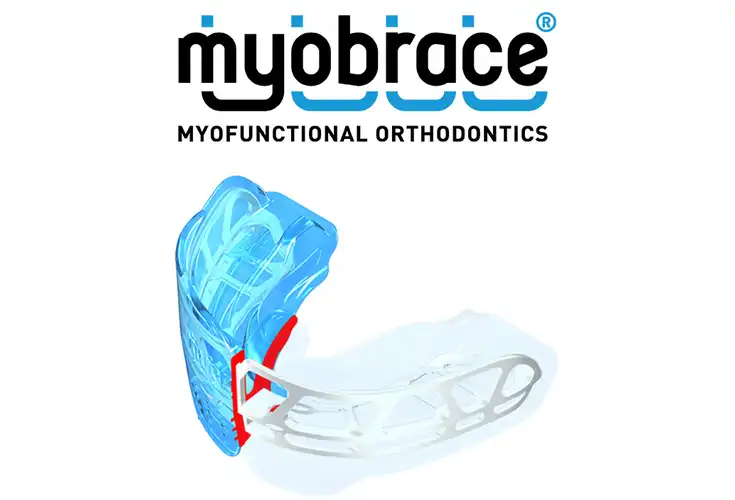 The Myobrace®System - Preventive Pre-orthodontic Treatment