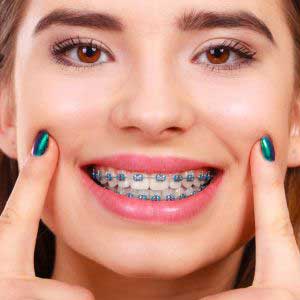 Orthodontics at Forest Hill